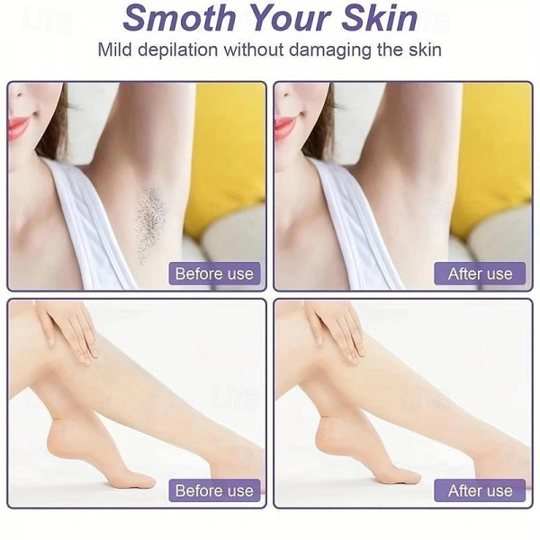 Magic Hair Eraser Remover For Women And Men Back Arms And Legs, Reusable And Washable, Painless Exfoliator Hair Remover Device, Bikini Trimmer, Portable Epilator Magic Hair Eraser Remover For Women And Men Back Arms And Legs, Reusable And Washable, Painless Exfoliator Hair Remover Device, Bikini Trimmer, Portable Epilator