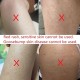 Magic Hair Eraser Device - Effortless &amp; Painless Hair Remover for All Body - Reusable, Washable, Bikini Trimmer &amp; Portable Epilator - Gentle, Long-Lasting Results for Women &amp; Men