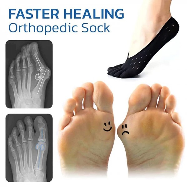 Orthoes Bunion Relief Socks Women - Orthopedic Toe Compression Sock - Projoint Antibunions Health Sock - Sock Align Toe Socks for Bunion - Anti Bunion Socks for Women and Men Orthoes Bunion Relief Socks Women - Orthopedic Toe Compression Sock - Projoint Antibunions Health Sock - Sock Align Toe Socks for Bunion - Anti Bunion Socks for Women and Men