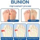 Orthoes Bunion Relief Socks Women - Orthopedic Toe Compression Sock - Projoint Antibunions Health Sock - Sock Align Toe Socks for Bunion - Anti Bunion Socks for Women and Men Orthoes Bunion Relief Socks Women - Orthopedic Toe Compression Sock - Projoint Antibunions Health Sock - Sock Align Toe Socks for Bunion - Anti Bunion Socks for Women and Men