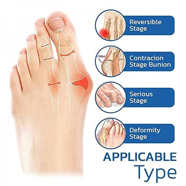 Orthoes Bunion Relief Socks Women - Orthopedic Toe Compression Sock - Projoint Antibunions Health Sock - Sock Align Toe Socks for Bunion - Anti Bunion Socks for Women and Men Orthoes Bunion Relief Socks Women - Orthopedic Toe Compression Sock - Projoint Antibunions Health Sock - Sock Align Toe Socks for Bunion - Anti Bunion Socks for Women and Men